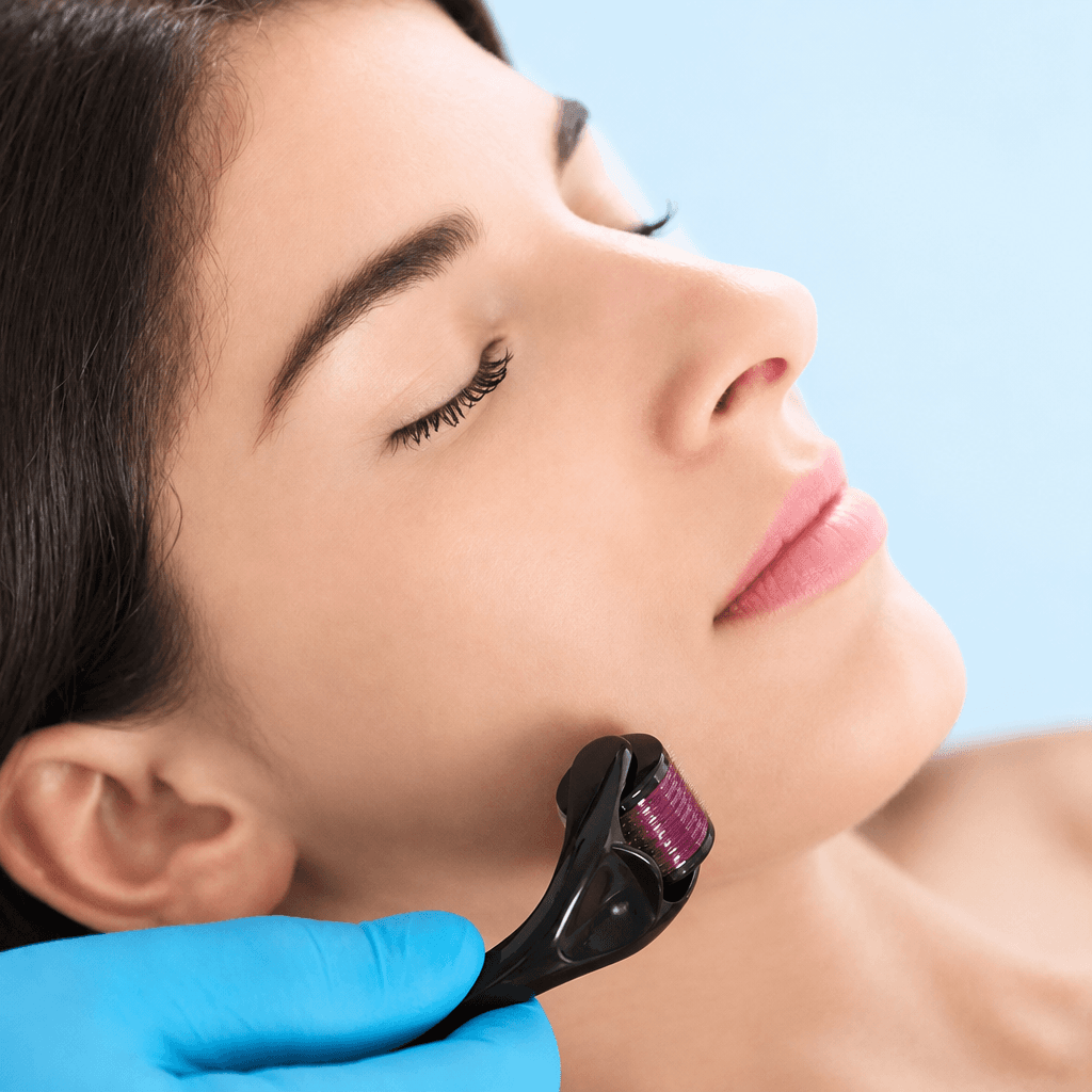 Microneedling Derma Roller — 540 Needles