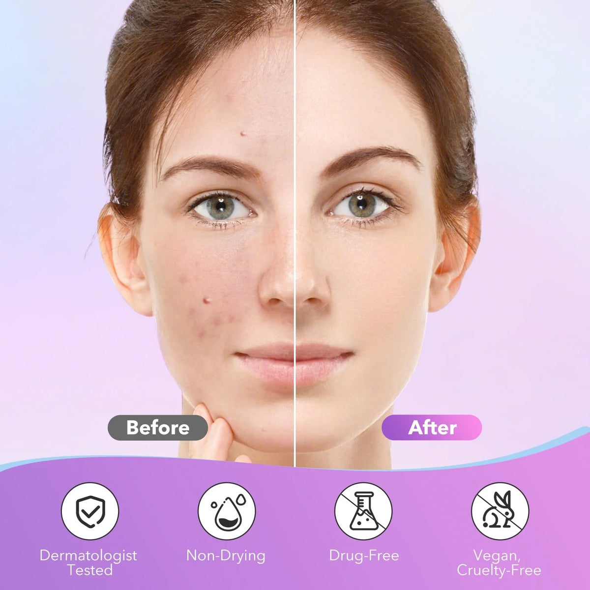 StarPatch — Hydrocolloid Star Blemish Patches